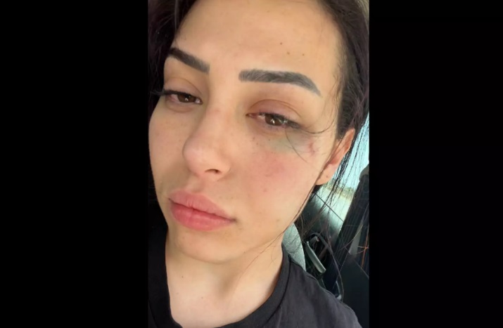 Χειροπέδες επίθεσης σε 25χρονη γυναίκα